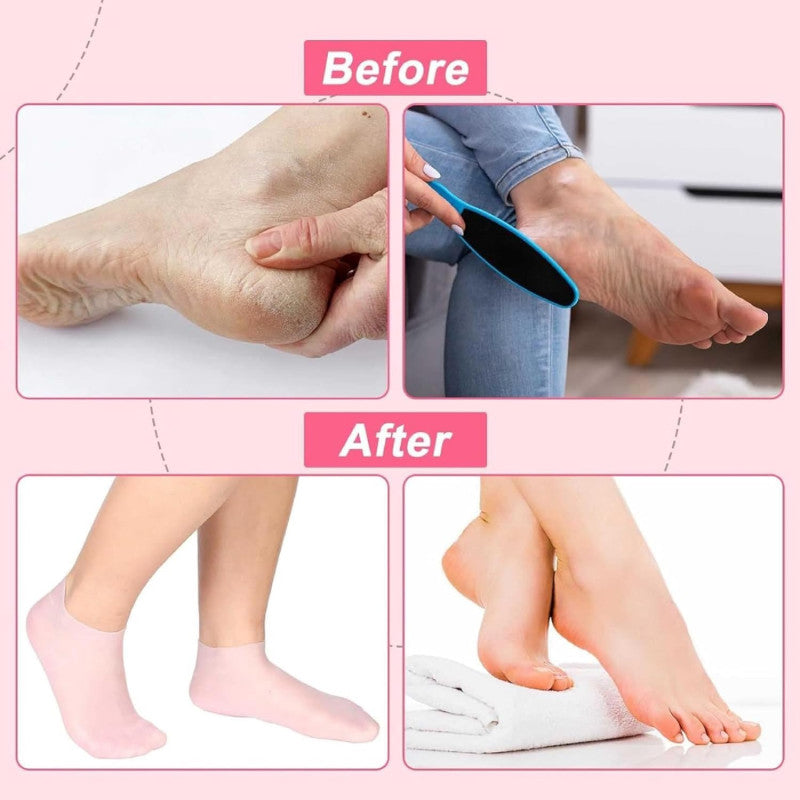 1 Pair Silicone Gel Moisturizing Sock